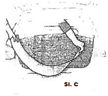 montaza folija